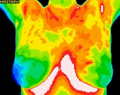 breast anterior thermography image