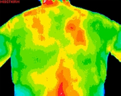 breast posterior thermography image